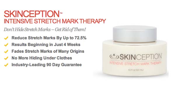 skinception stretch mark therapy review